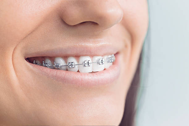 Best Traditional Braces  in Union City, MI